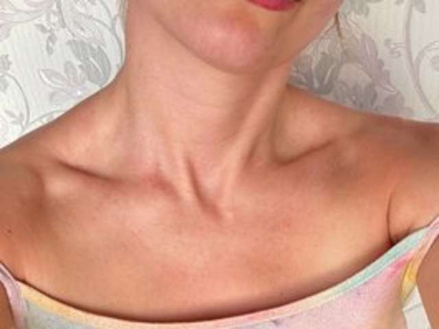 go to chat with Cherry-laddy